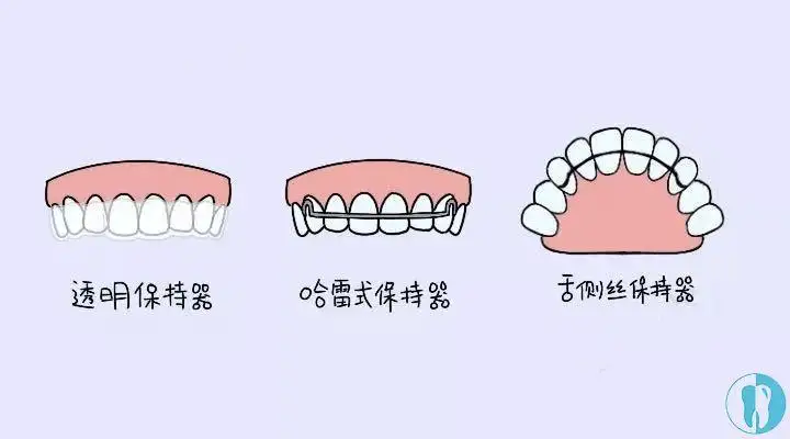 上海中博惠众口腔医院-保持器